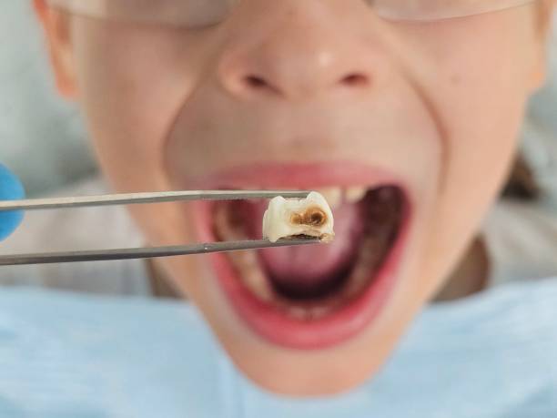 Best Emergency Treatment for Dental Infections or Abscesses in Mayflower, AR